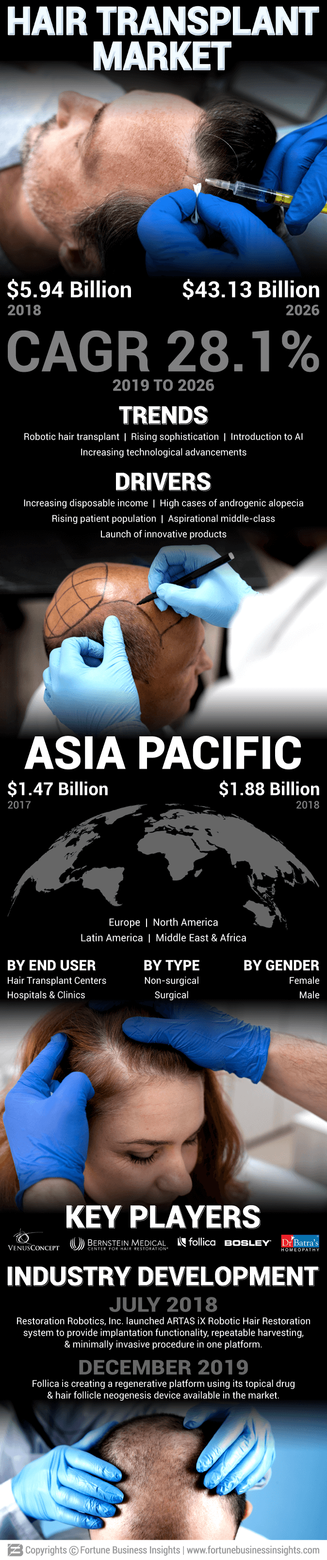 Hair Transplant Market