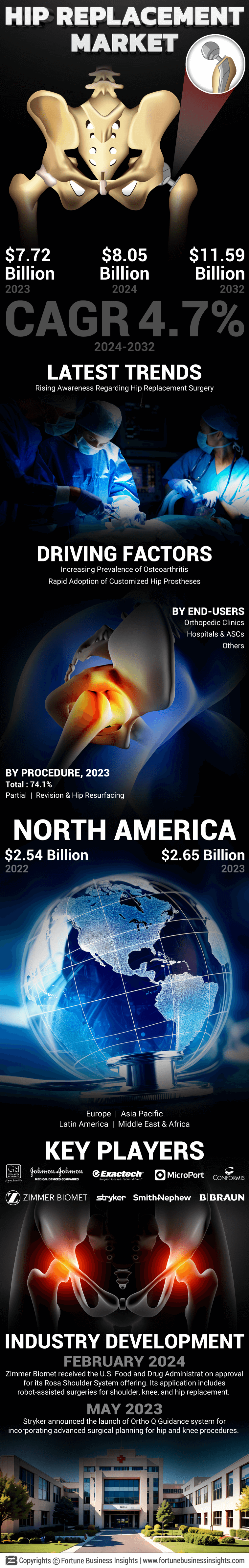 Hip Replacement Implants Market